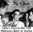 1956 Mens Waterpolo Team Hungary: Zador bleeding